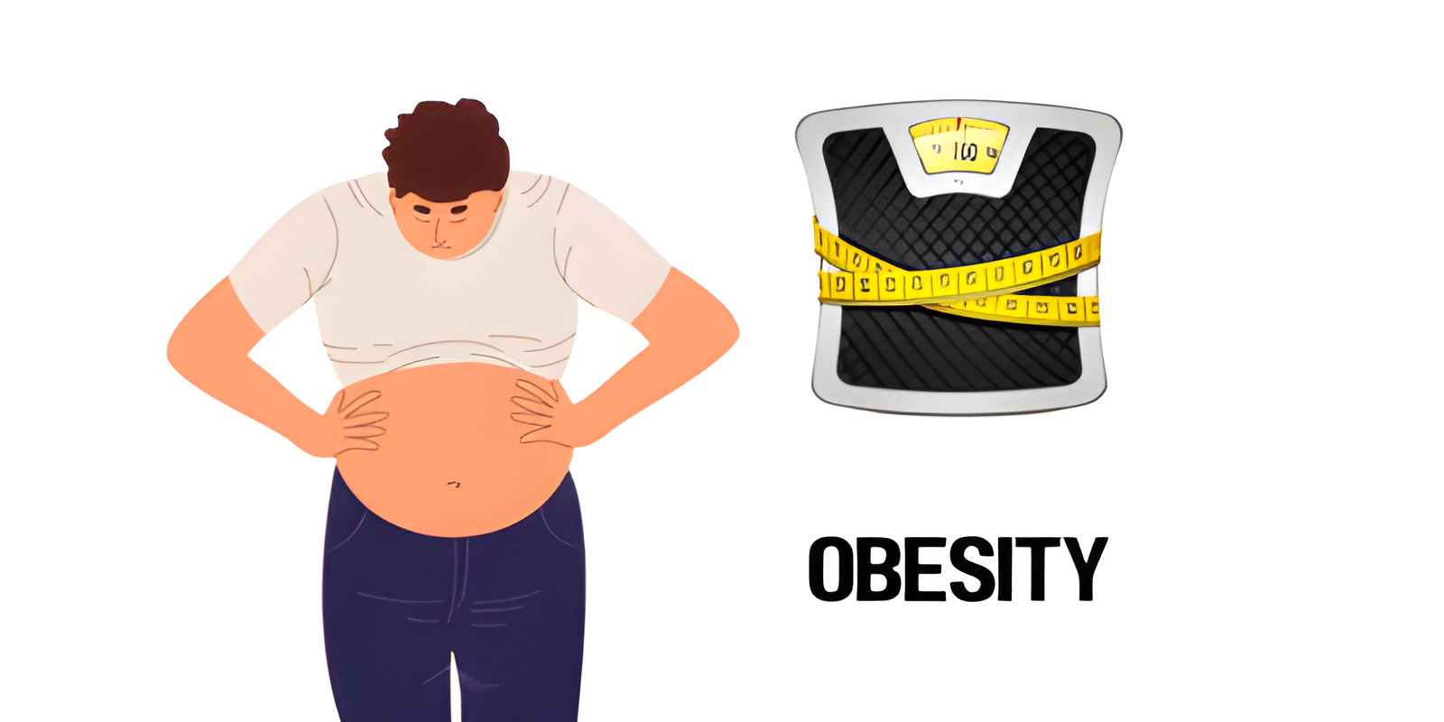 Obesity | Kamayog